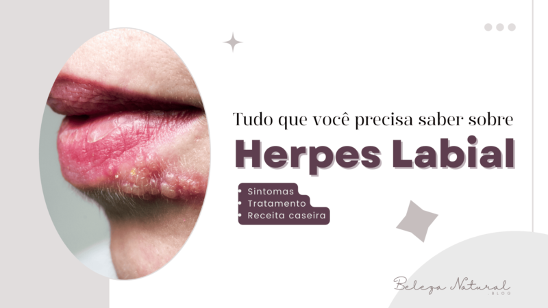 Herpes Labial: Oque é? Sintomas e Tratamentos.
